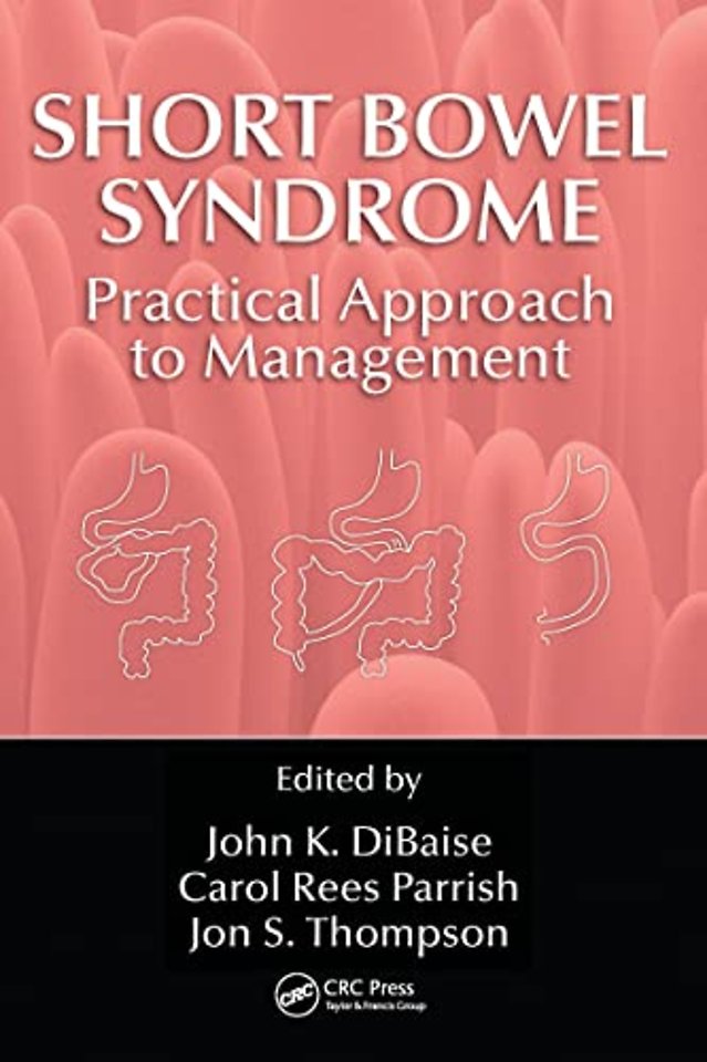 Short Bowel Syndrome