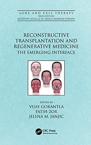 Reconstructive Transplantation and Regenerative Medicine