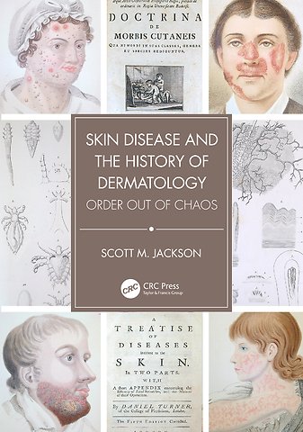 Skin Disease and the History of Dermatology