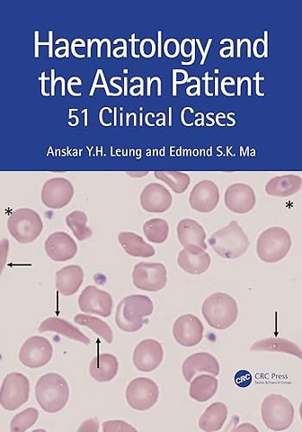 Haematology and the Asian Patient