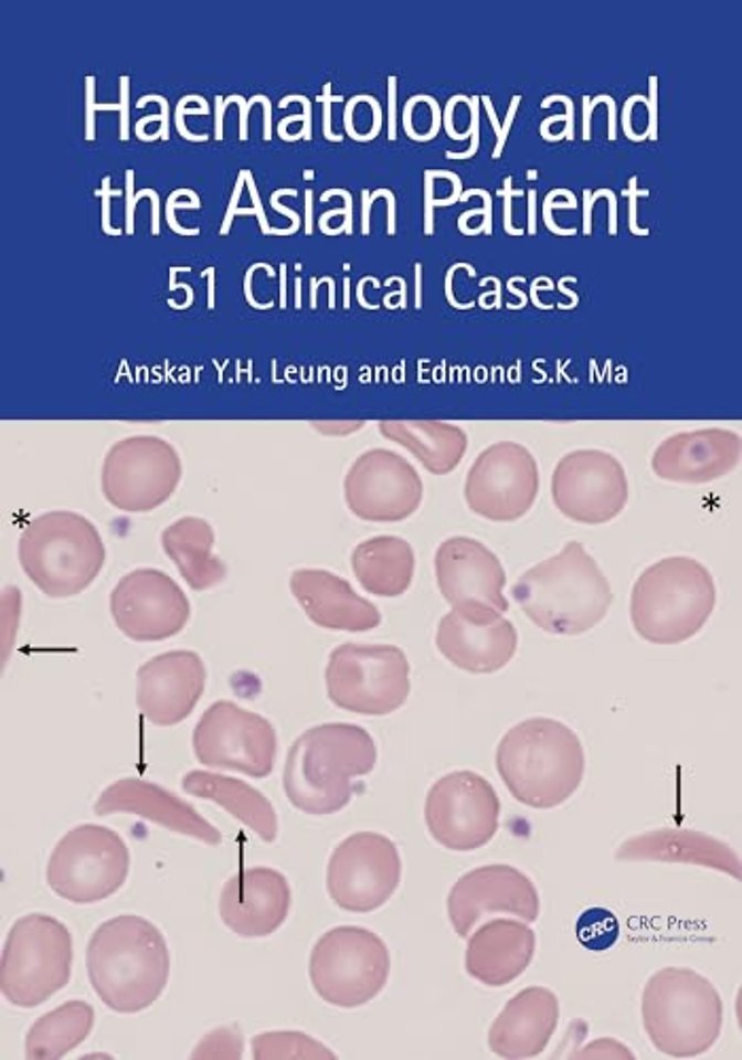 Haematology and the Asian Patient