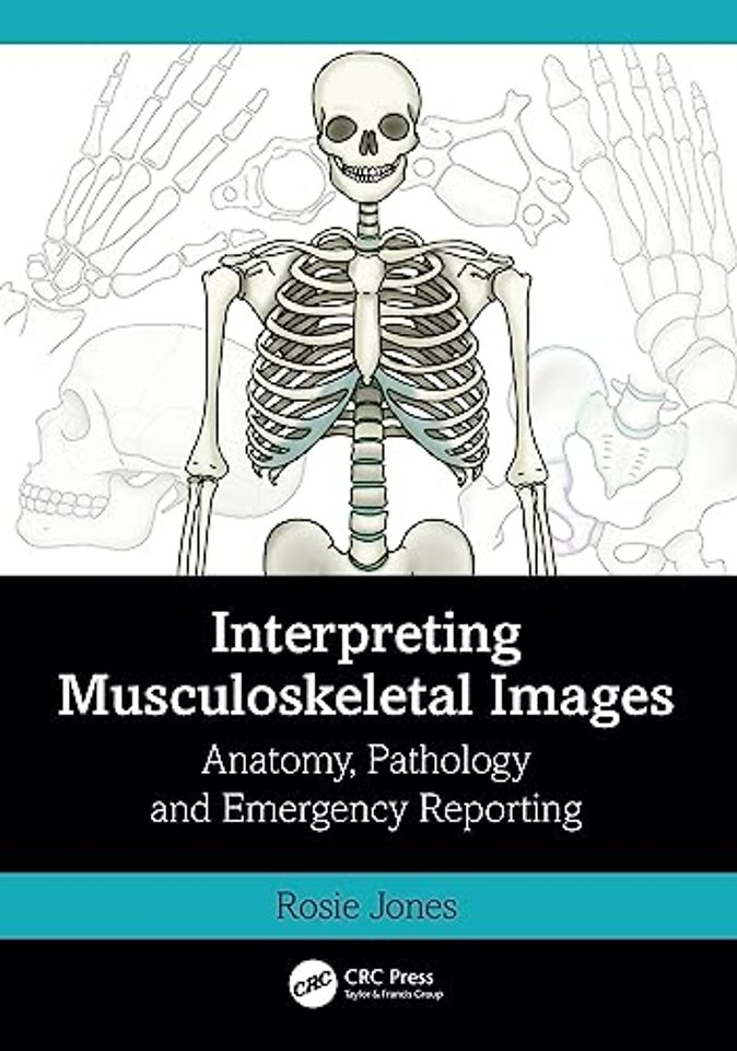 Interpreting Musculoskeletal Images