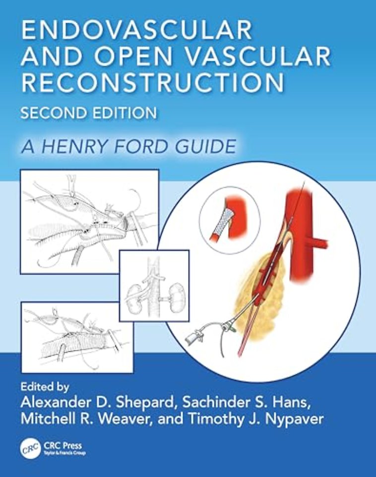 Endovascular and Open Vascular Reconstruction