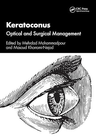 Keratoconus