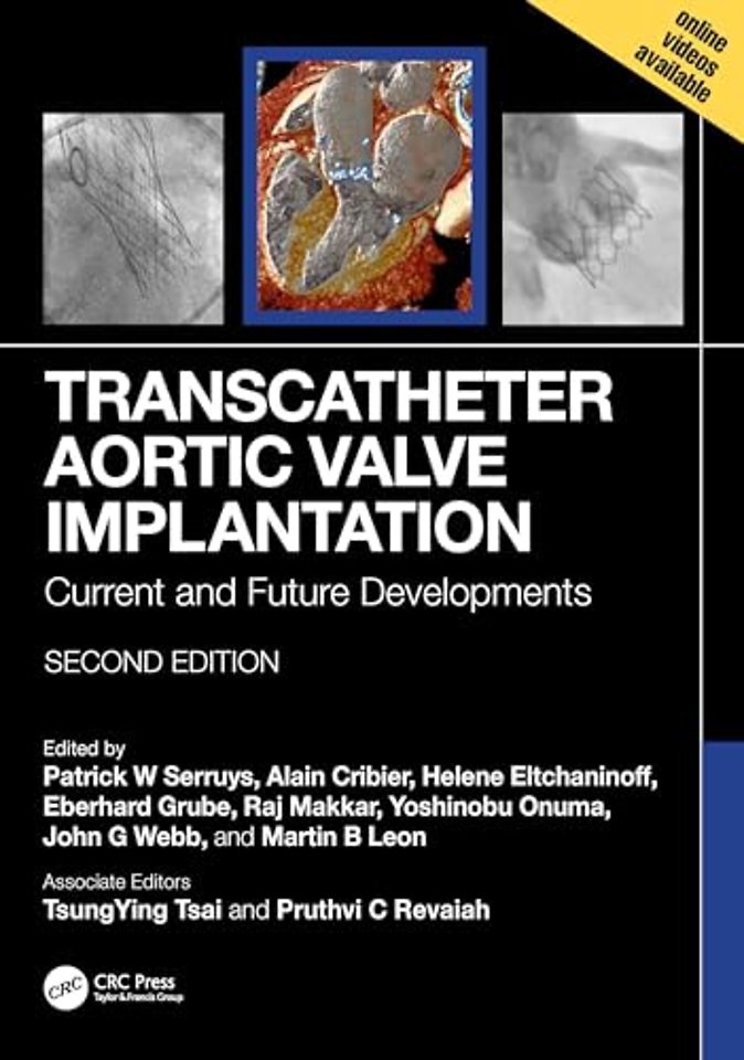Transcatheter Aortic Valve Implantation