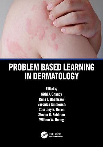 Problem Based Learning in Dermatology