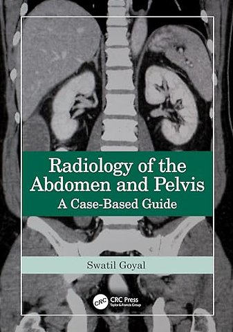 Radiology of the Abdomen and Pelvis