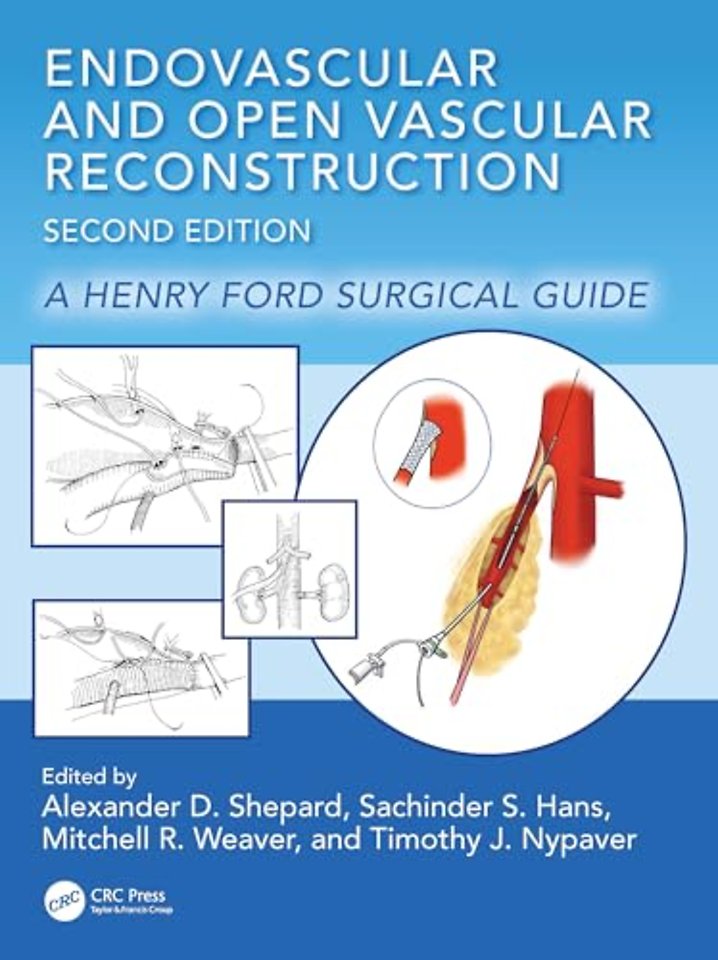 Endovascular and Open Vascular Reconstruction