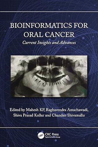 Bioinformatics for Oral Cancer