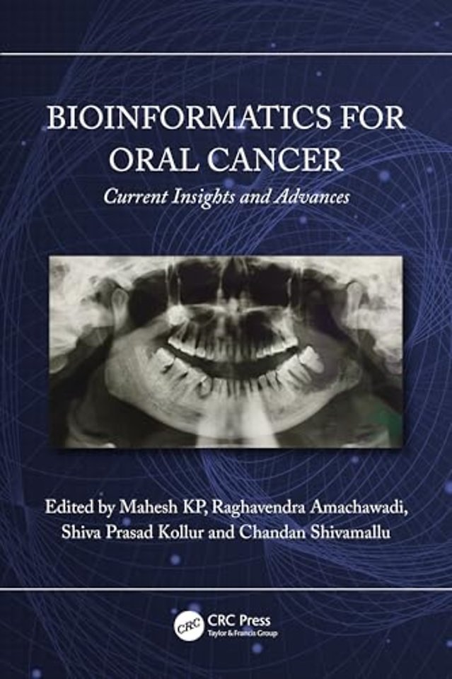 Bioinformatics for Oral Cancer