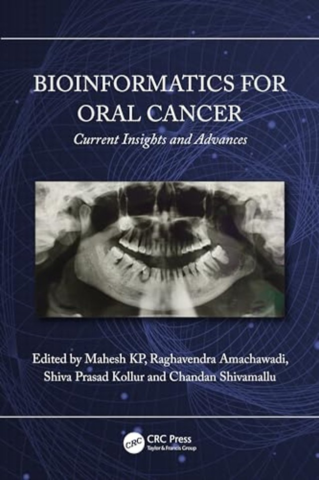 Bioinformatics for Oral Cancer