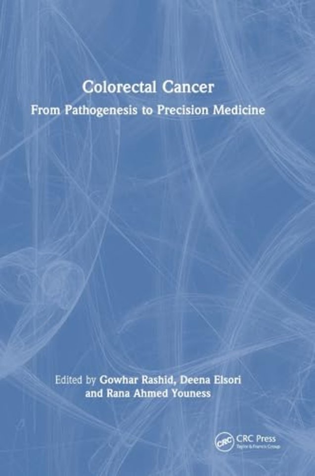 Colorectal Cancer