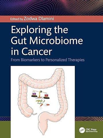 Exploring the Gut Microbiome in Cancer