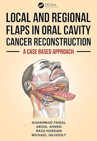 Local and Regional Flaps in Oral Cavity Cancer Reconstruction
