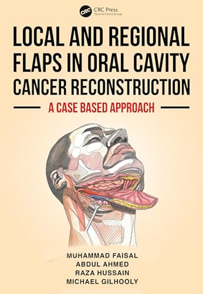 Local and Regional Flaps in Oral Cavity Cancer Reconstruction
