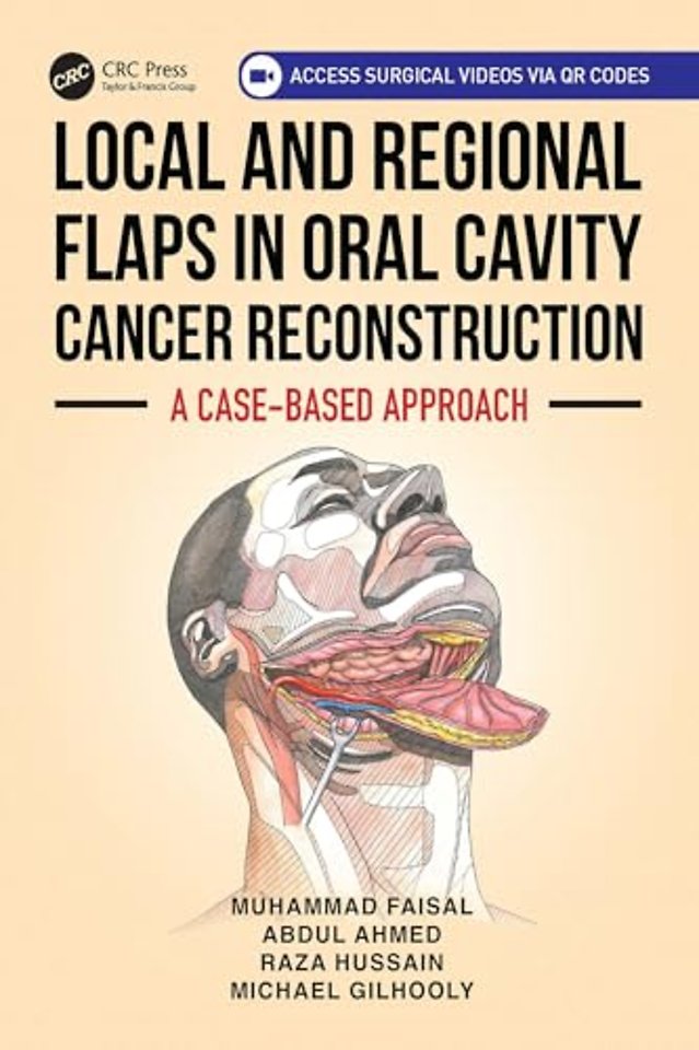Local and Regional Flaps in Oral Cavity Cancer Reconstruction