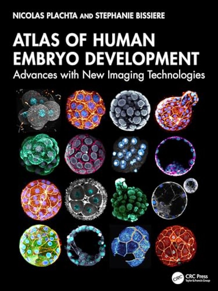 Atlas of Human Embryo Development