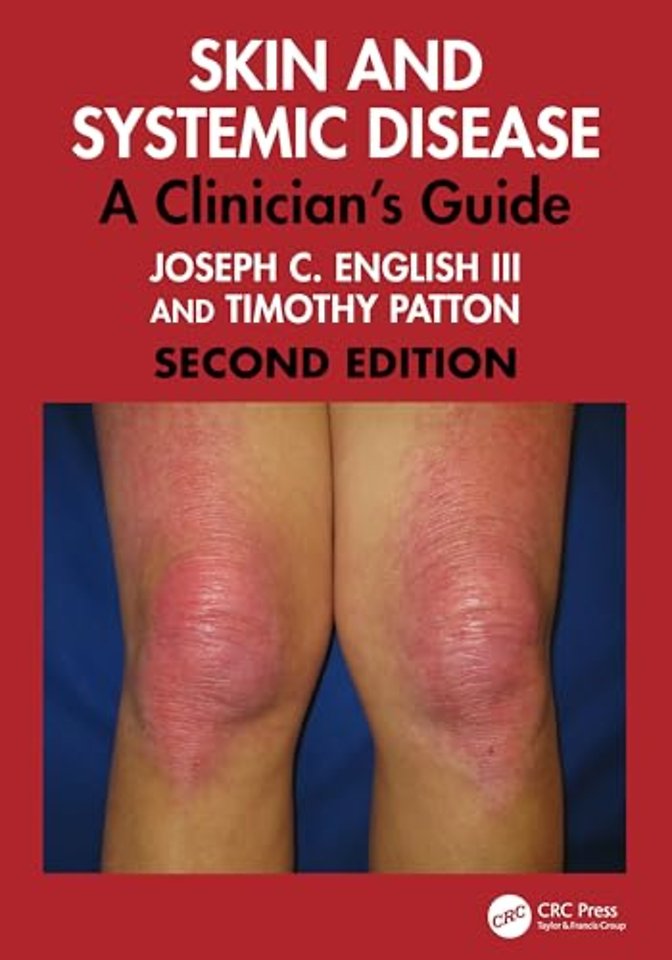 Skin and Systemic Disease