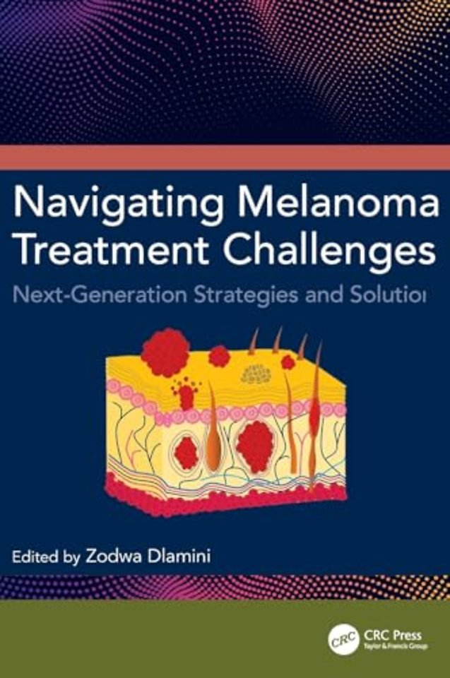 Navigating Melanoma Treatment Challenges