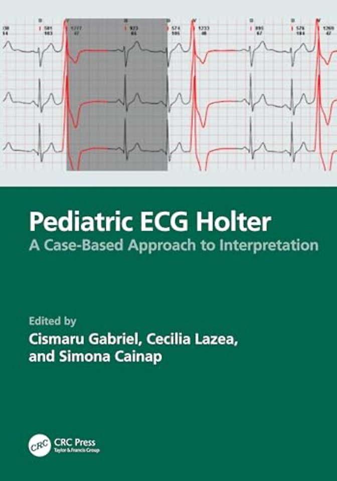 Pediatric ECG Holter