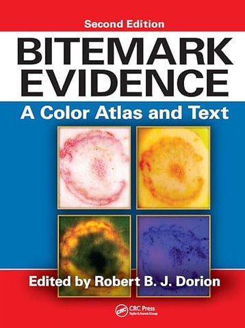 Bitemark Evidence