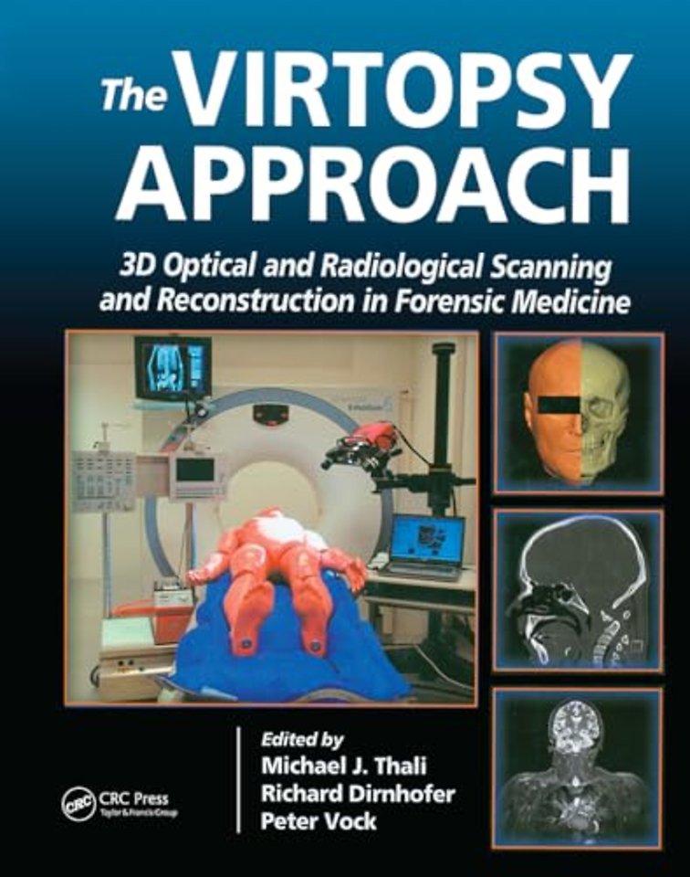 The Virtopsy Approach