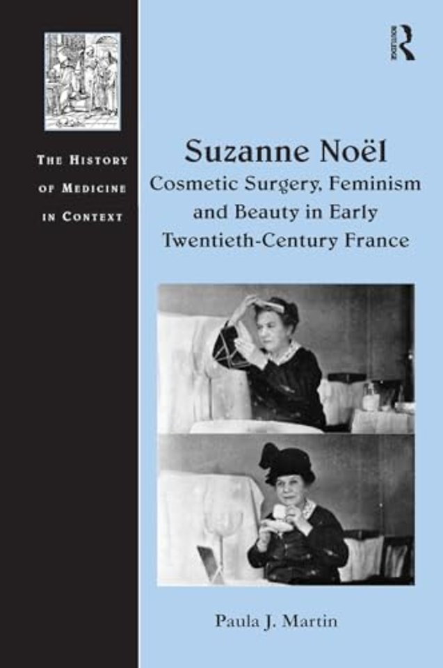 Suzanne Noel: Cosmetic Surgery, Feminism and Beauty in Early Twentieth-Century France