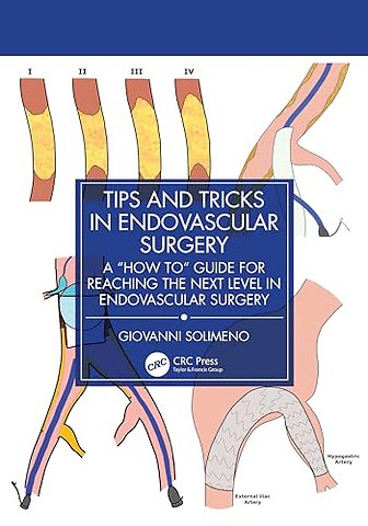 Tips and Tricks in Endovascular Surgery