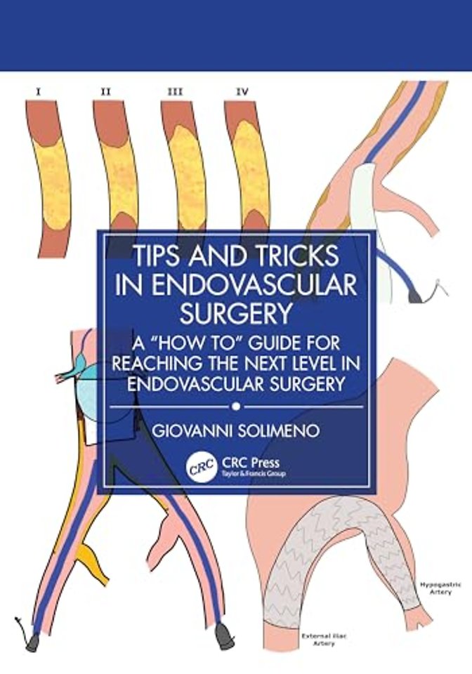 Tips and Tricks in Endovascular Surgery