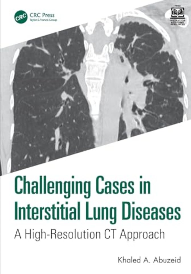 Challenging Cases in Interstitial Lung Diseases