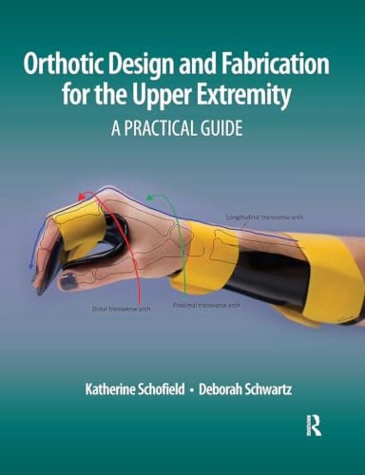 Orthotic Design and Fabrication for the Upper Extremity