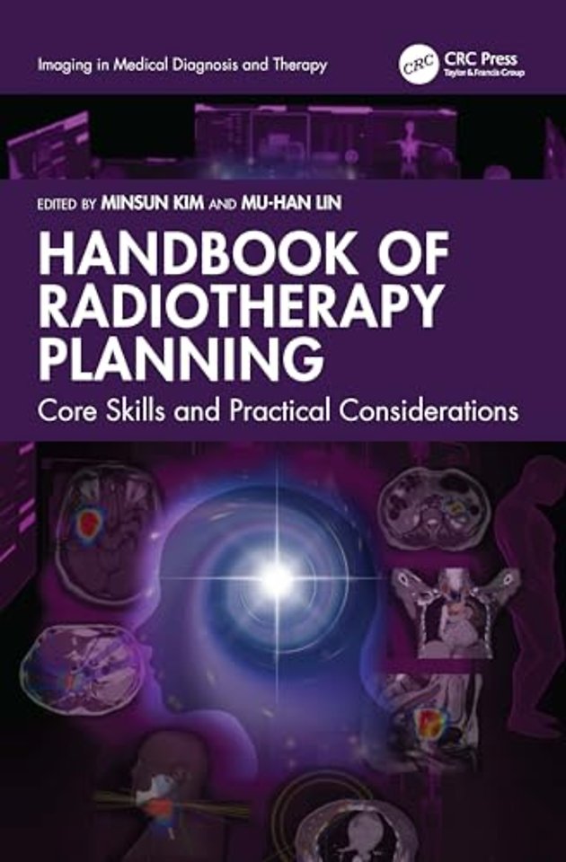 Handbook of Radiotherapy Planning