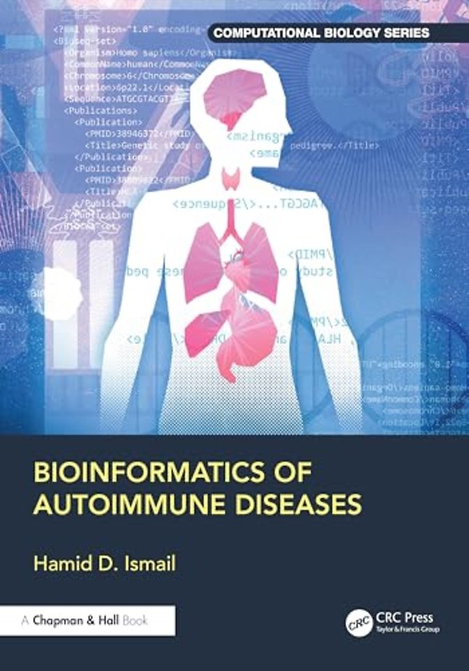 Bioinformatics of Autoimmune Diseases