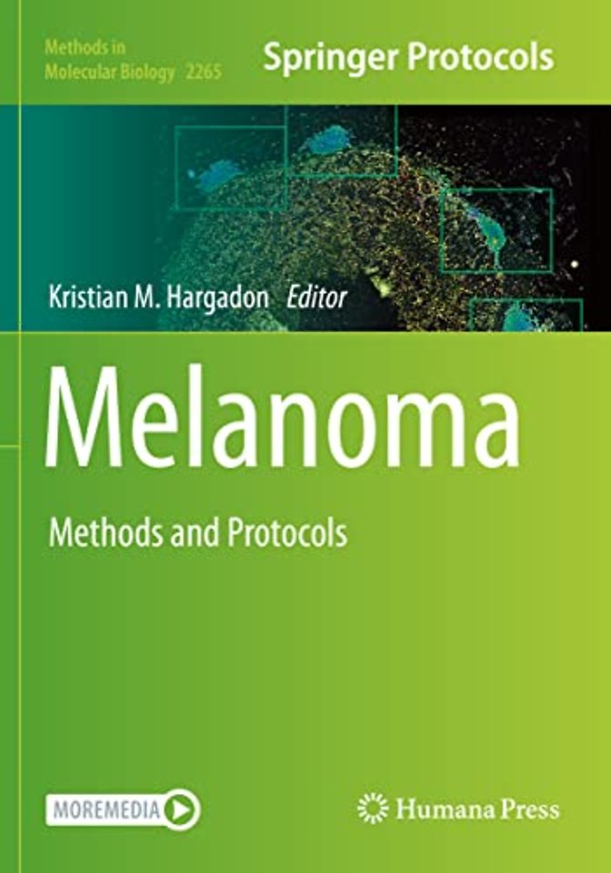 Melanoma
