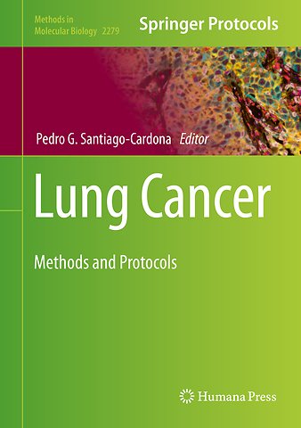Lung Cancer