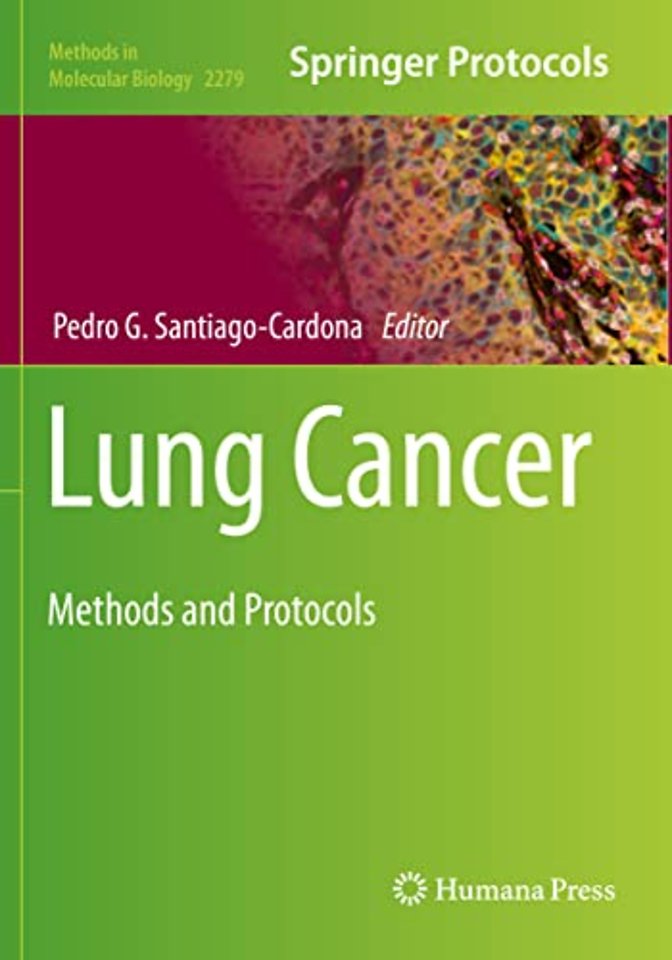 Lung Cancer