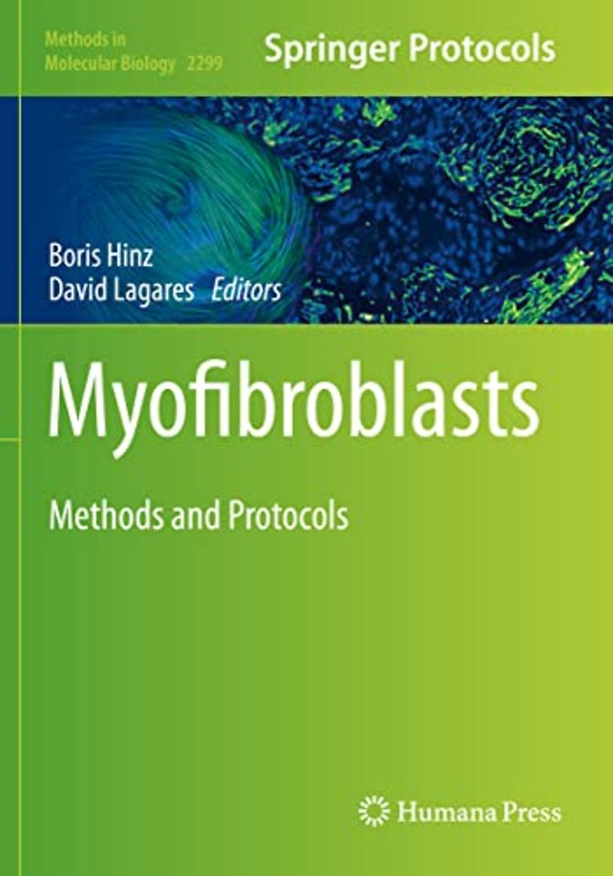 Myofibroblasts