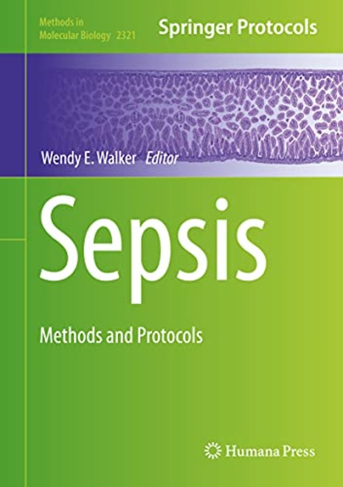 Sepsis