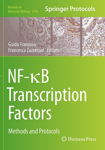 NF-κB Transcription Factors