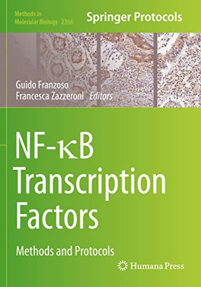 NF-κB Transcription Factors