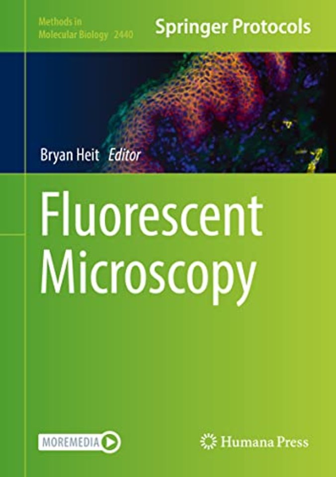 Fluorescent Microscopy