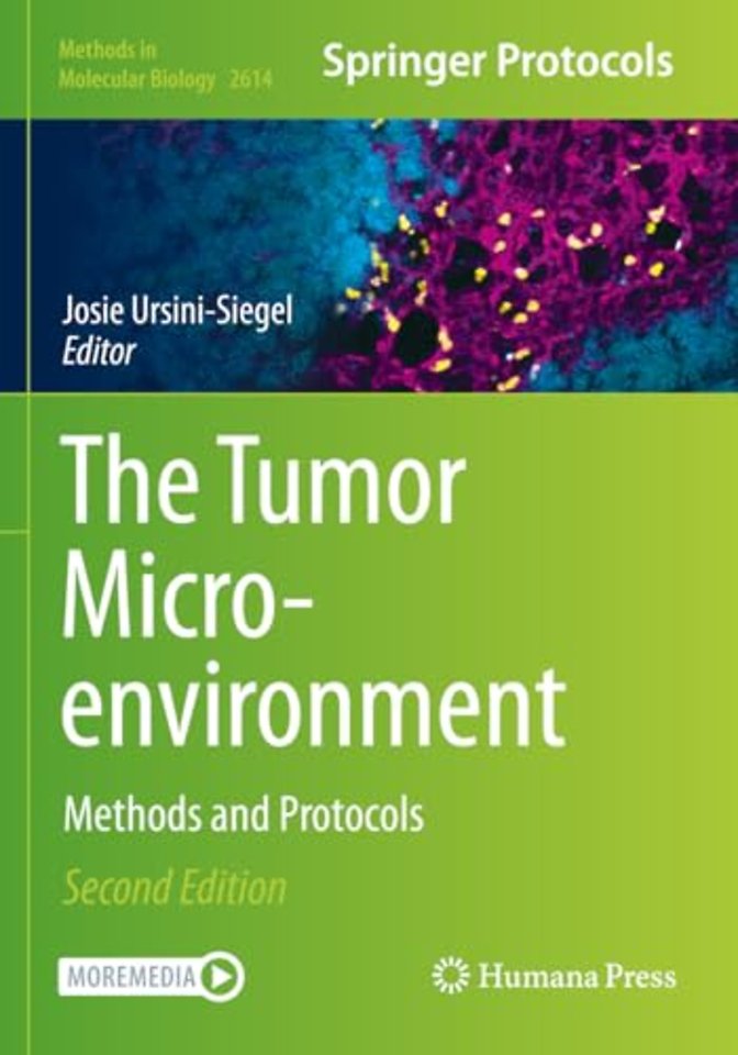 The Tumor Microenvironment