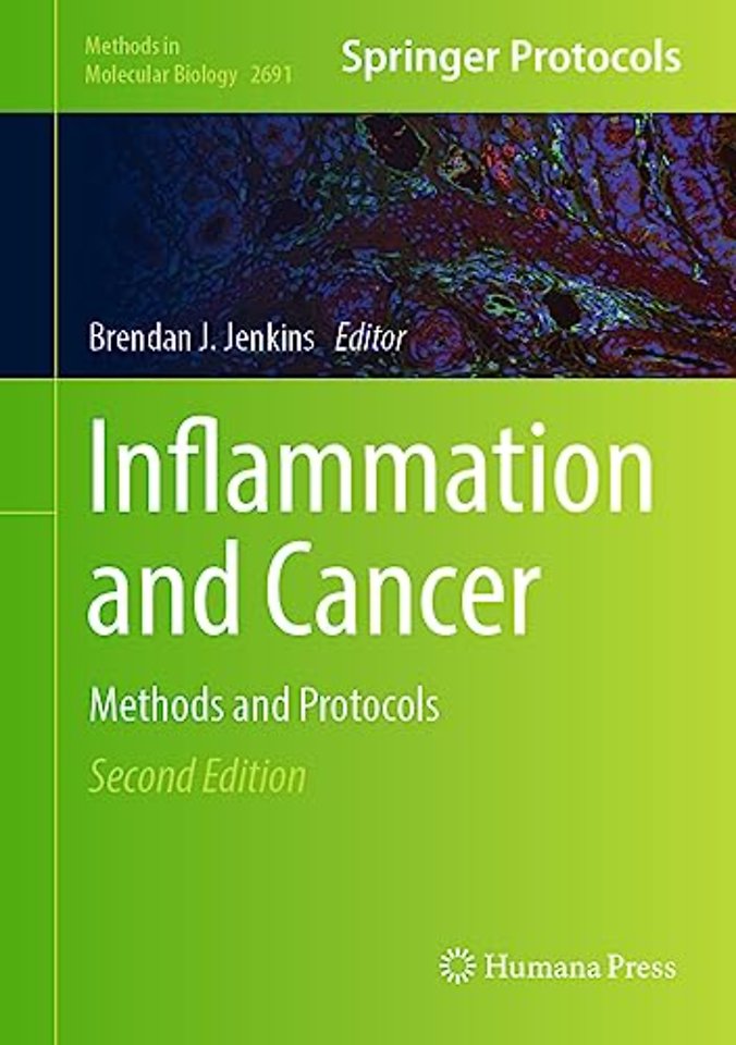 Inflammation and Cancer