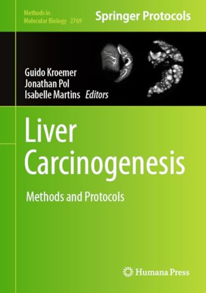 Liver Carcinogenesis
