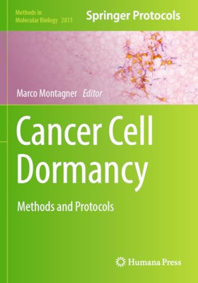 Cancer Cell Dormancy
