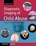 Diagnostic Imaging of Child Abuse