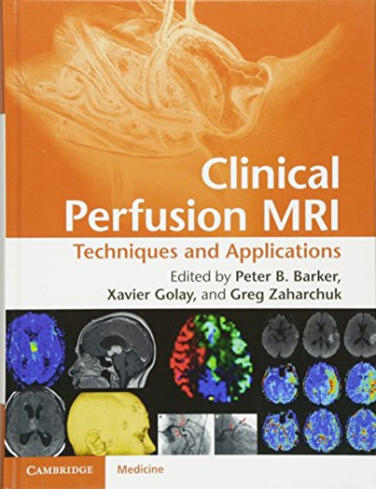 Clinical Perfusion MRI