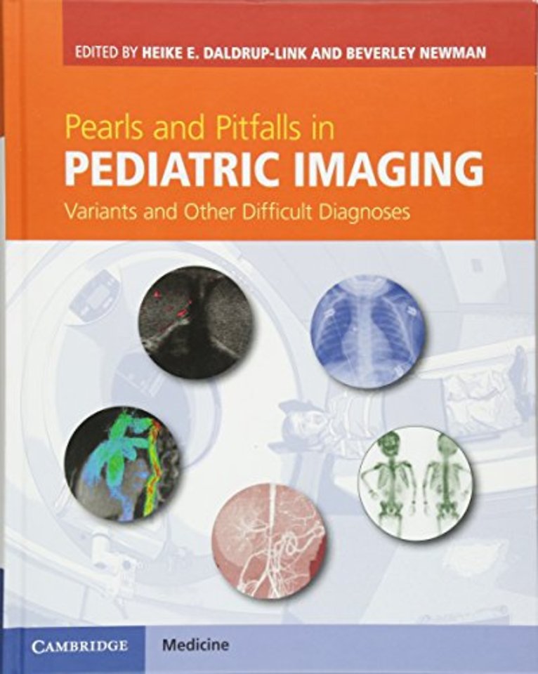 Pearls and Pitfalls in Pediatric Imaging