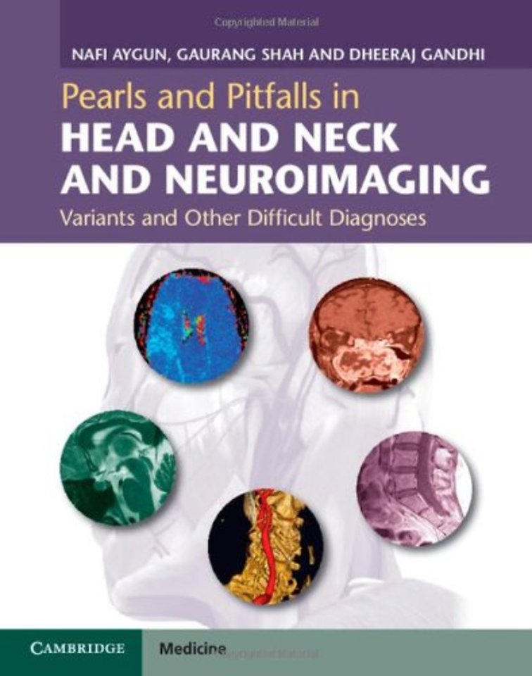 Pearls and Pitfalls in Head and Neck and Neuroimaging