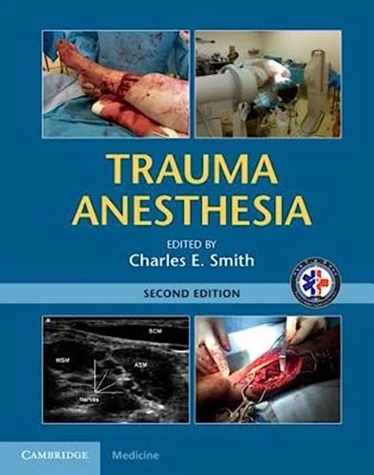 Trauma Anesthesia